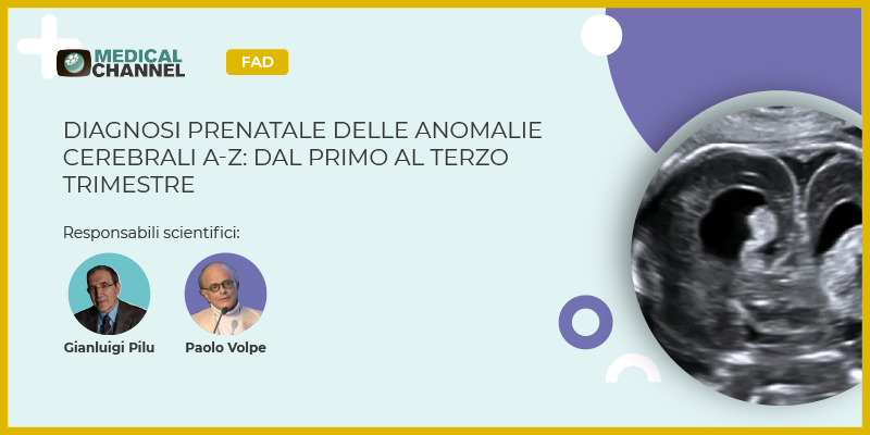 Diagnosi prenatale delle anomalie cerebrali A-Z: dal primo al terzo trimestre - FAD