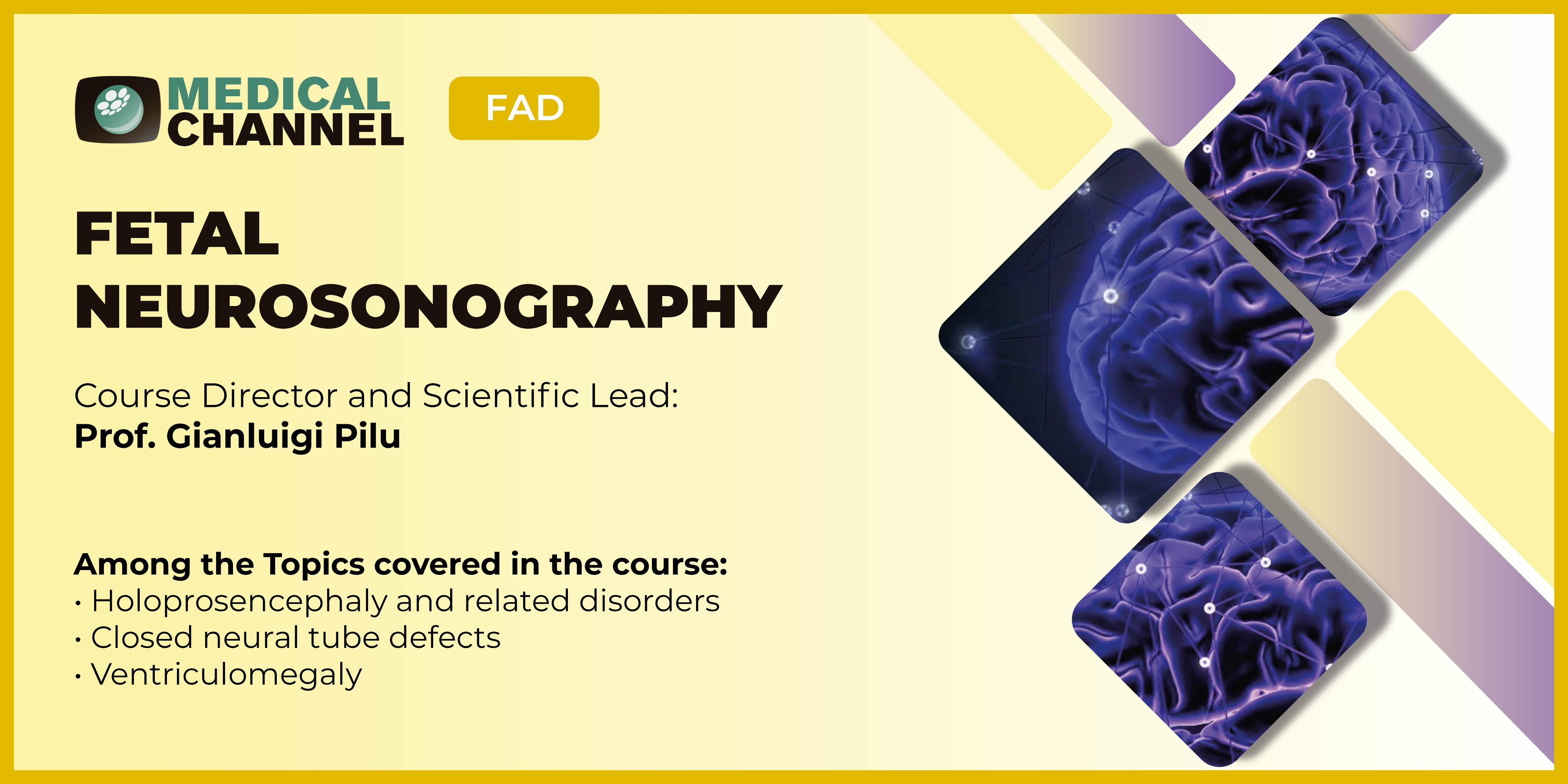 Fetal Neurosonography