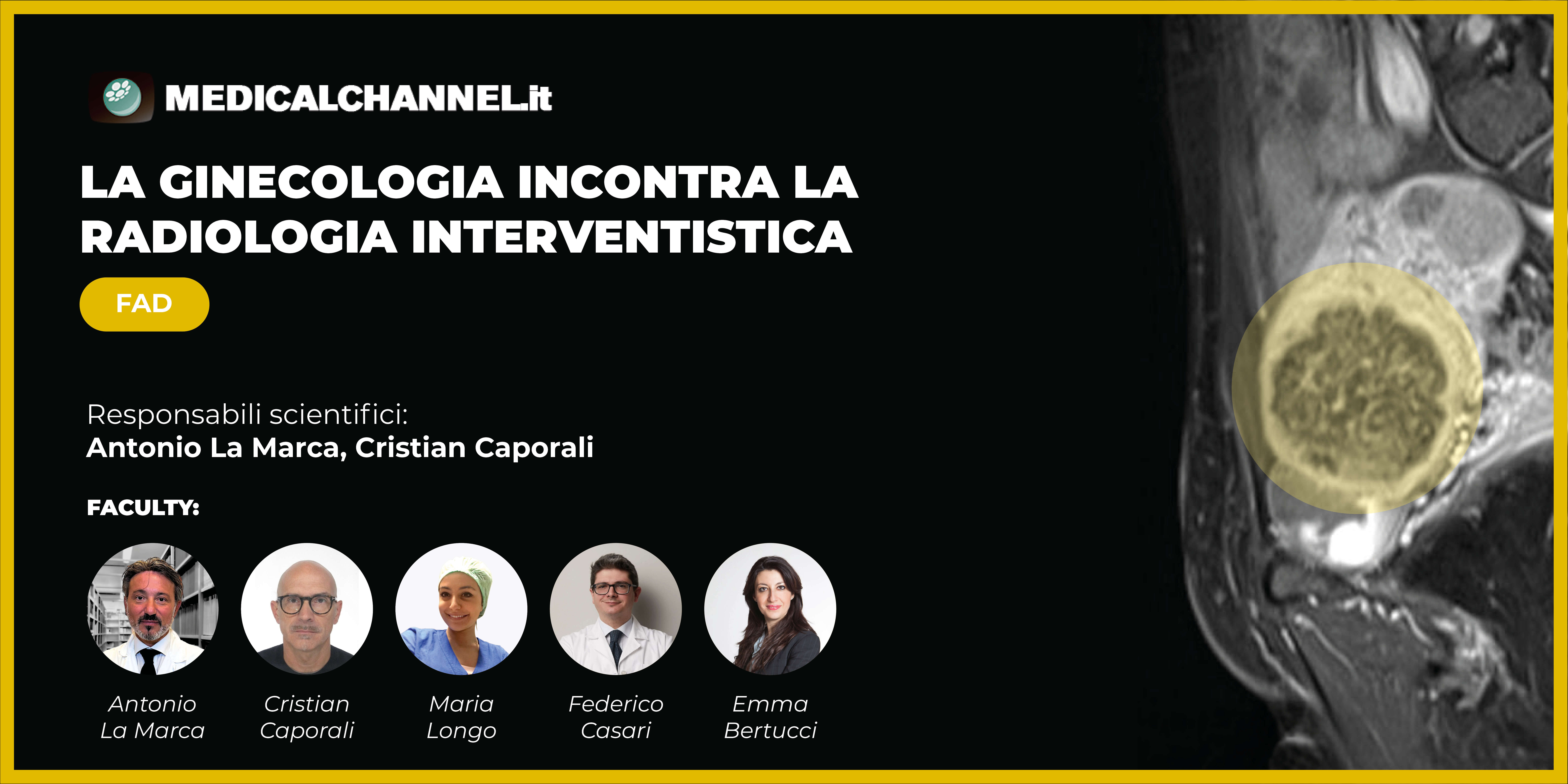 La ginecologia incontra la radiologia interventistica - FAD